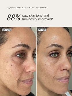 Alpha-H Liquid Gold with 5% Glycolic Acid