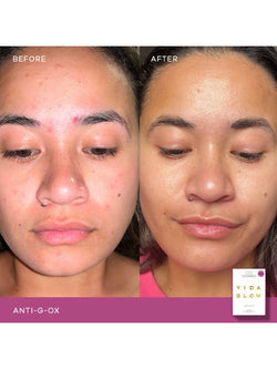 Vida Glow Anti G-Ox Citrus