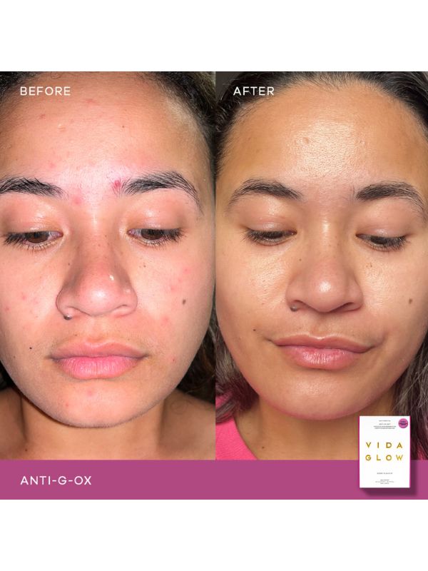 Vida Glow Anti G-Ox Citrus