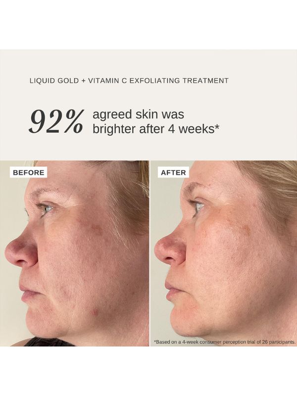 Alpha-H Liquid Gold Exfoliating Treatment with Vitamin C