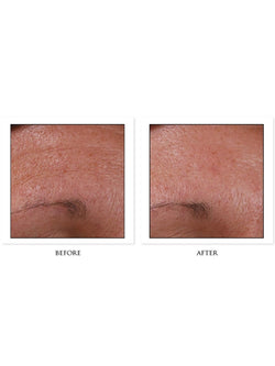 CosMedix Hydrate+ Before/After