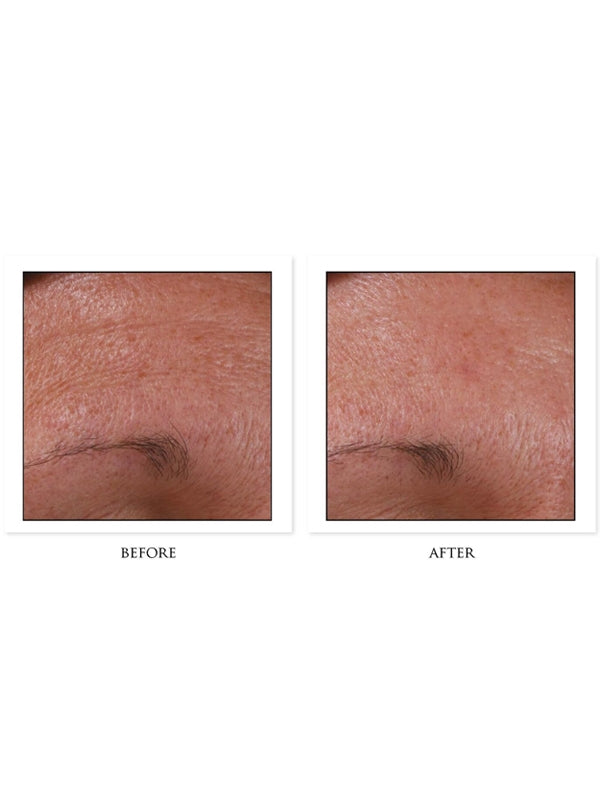 CosMedix Hydrate+ Before/After
