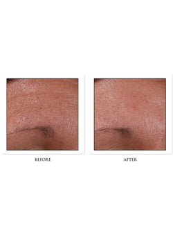 CosMedix Serum 16 Before/After