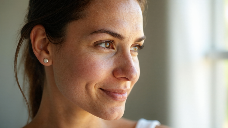 Close-up of woman's face showing facial pigmentation including dark spots on cheeks and forehead in natural lighting