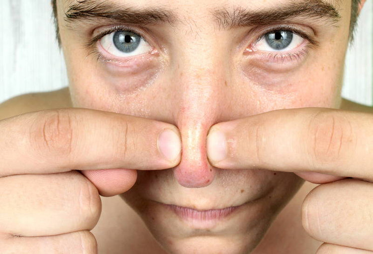 Why do we have Blackheads?