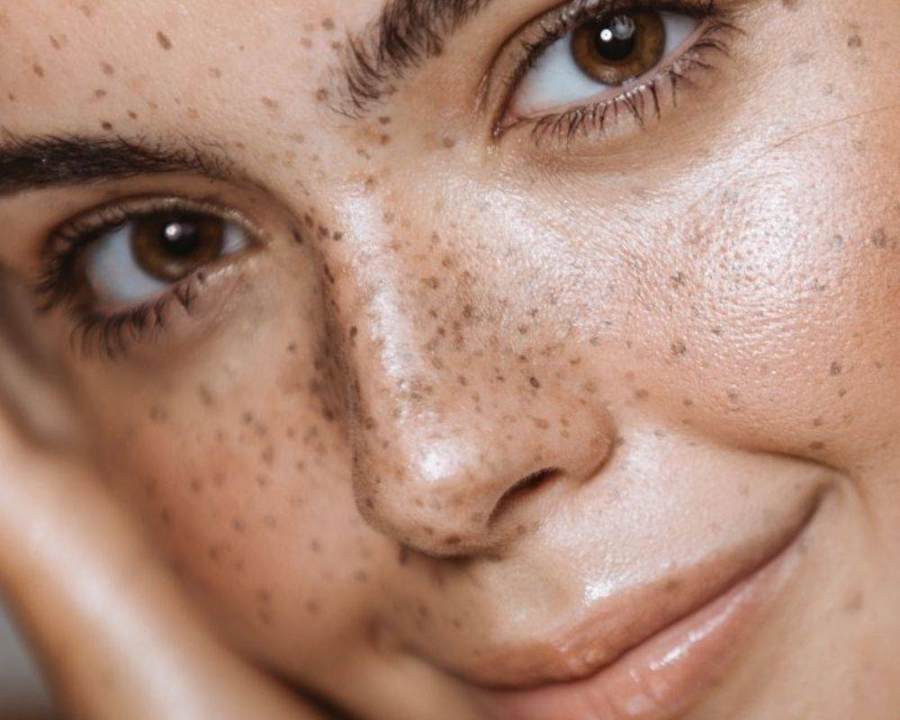 Our Top 8 Tips to Ban the Winter Skin Dullness
