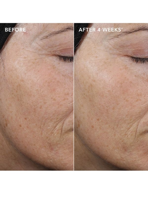 Image Skincare Ageless+ Retinol Pure Liquid Retinol 0.3%