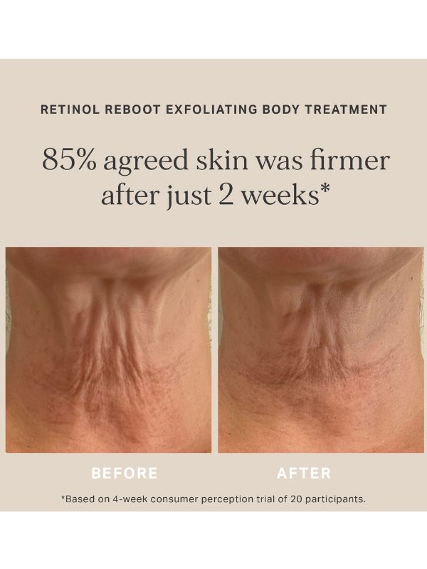 Alpha-H Retinol Reboot Exfoliating Body Treatment