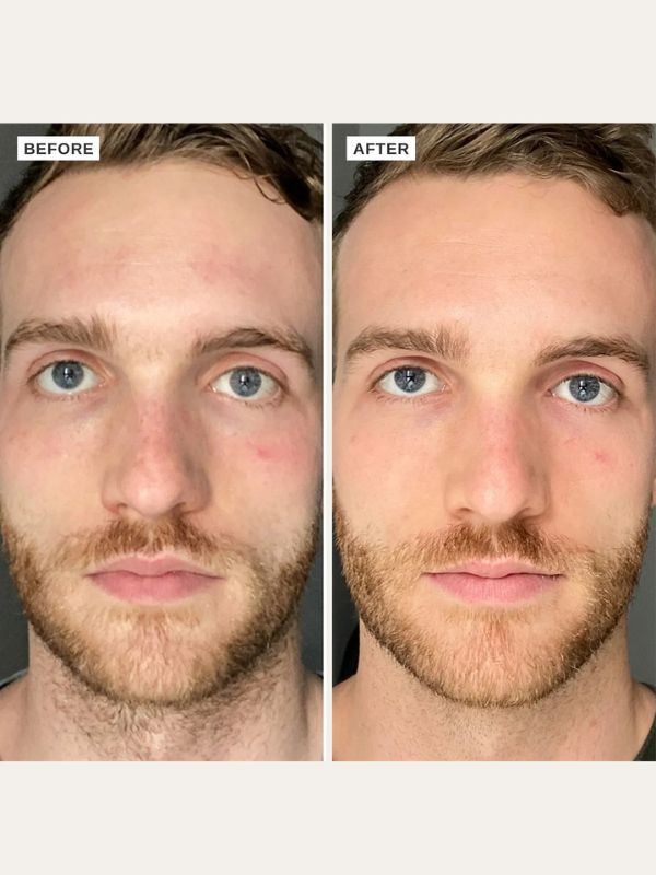 Alpha-H Vitamin B Serum with 5% Niacinamide