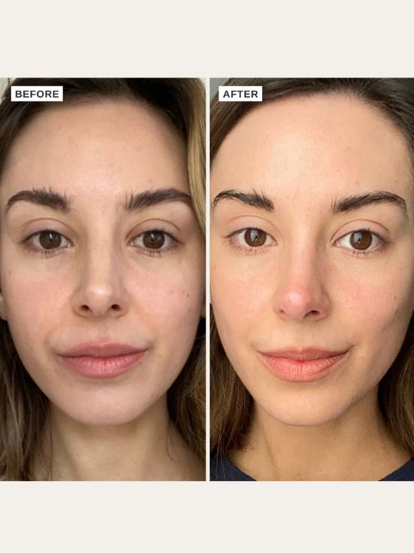 Alpha-H Vitamin C Serum with 10% Ethyl Ascorbic Acid