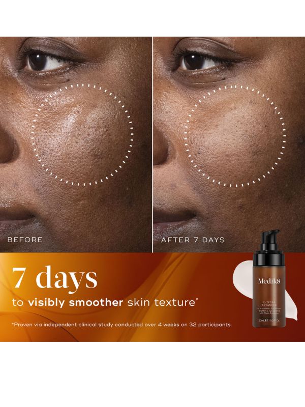 Medik8 C-Tetra Advanced