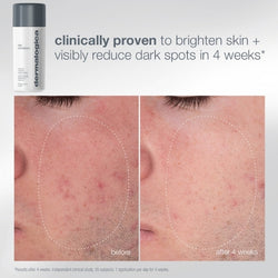 Dermalogica Expert Cleanse and Glow