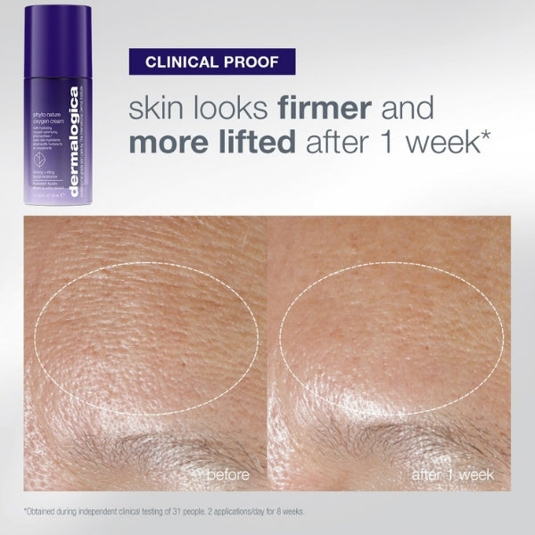 Dermalogica The Expert Lift