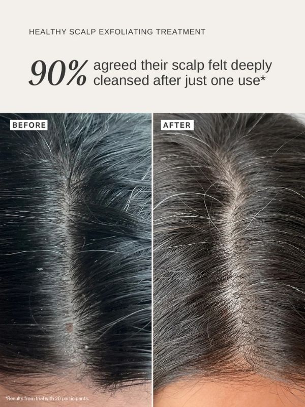 Alpha-H Healthy Scalp Exfoliating Treatment with Australian Desert Lime