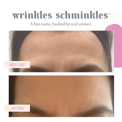 Wrinkles Schminkles Forehead Smoothing Kit (2 Patches)