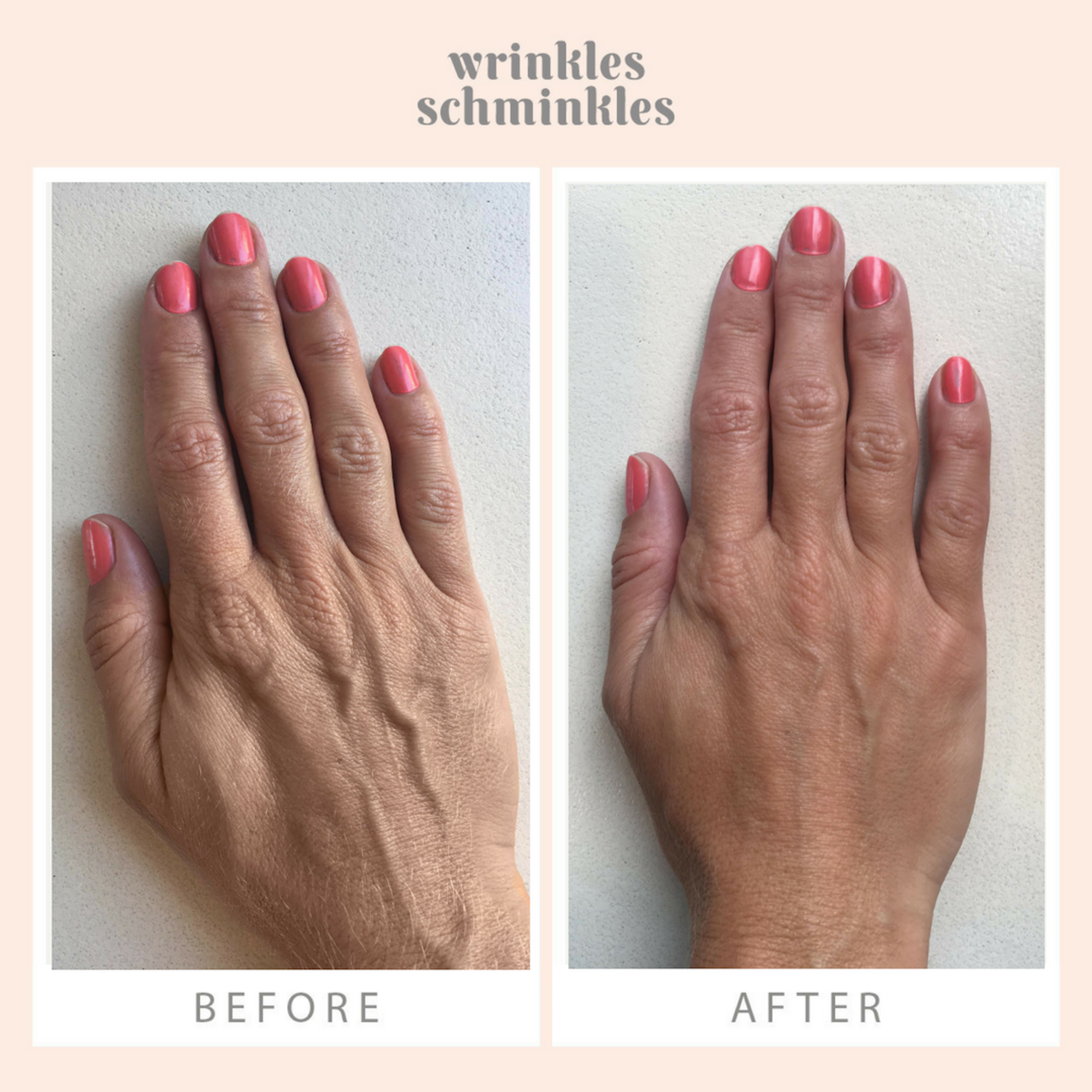 Wrinkles Schminkles Hand Wrinkle Patches Kit (2 Patches)