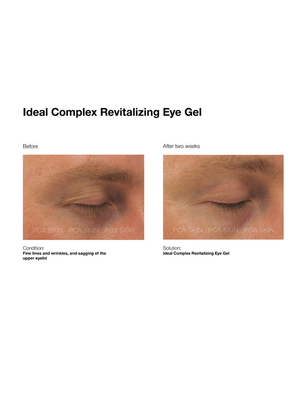 PCA Skin Ideal ComplexÔö¼┬½ Revitalizing Eye Gel